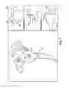 Fig. 09 - System of preoperative planning and provision of patient-specific surgical aids