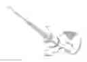Fig. 01 - Patient-specific total hip arthroplasty