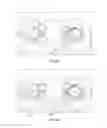 Fig. 07 - Patient-specific total hip arthroplasty