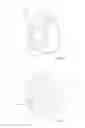 Fig. 10 - Patient-specific total hip arthroplasty