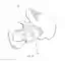 Fig. 12 - Patient-specific total hip arthroplasty