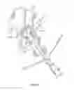 Fig. 16 - Patient-specific total hip arthroplasty