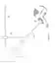 Fig. 19 - Patient-specific total hip arthroplasty