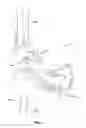 Fig. 02 - Custom radiographically designed cutting guides and instruments for use in total ankle replacement surgery