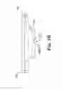 Fig. 09 - Subcutaneous implant integrated instrument