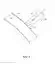 Fig. 03 - Needle assembly for pleural space insufflation and methods thereof