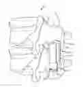 Fig. 01 - Interspinous process device and method