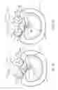 Fig. 08 - Interspinous process device and method
