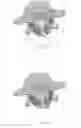 Fig. 05 - Pars Interarticularis Fracture Device