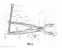 Fig. 02 - Distraction and compression in one plier
