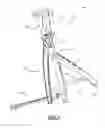 Fig. 04 - Distraction and compression in one plier