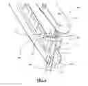 Fig. 07 - Distraction and compression in one plier