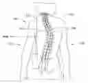 Fig. 01 - Skeletal manipulation method