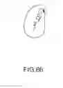 Fig. 52 - Electrosurgical device and methods