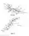 Fig. 04 - ELECTROSURGICAL SEALER AND DIVIDER