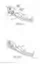 Fig. 14 - ELECTROSURGICAL SEALER AND DIVIDER