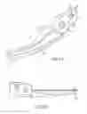 Fig. 15 - ELECTROSURGICAL SEALER AND DIVIDER