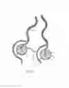 Fig. 09 - Ablation catheters