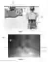 Fig. 02 - Surgical Targeting Systems and Methods