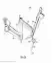 Fig. 06 - Manipulator arm-to-patient collision avoidance using a null-space