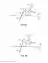 Fig. 08 - Manipulator arm-to-patient collision avoidance using a null-space