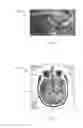 Fig. 06 - Method, system and apparatus for tracking surgical imaging devices