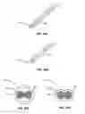 Fig. 33 - Tissue localization device and method of use thereof
