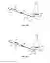 Fig. 37 - Tissue localization device and method of use thereof