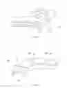 Fig. 12 - Three-dimensional markers for axiography and individual values determination