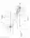 Fig. 04 - ORTHODONTIC APPLIANCE AND METHOD FOR CLASS II AND CLASS III MALOCCLUSION AND DENTAL ASYMMETRIC CORRECTION