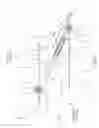 Fig. 05 - ORTHODONTIC APPLIANCE AND METHOD FOR CLASS II AND CLASS III MALOCCLUSION AND DENTAL ASYMMETRIC CORRECTION