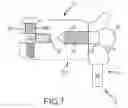 Fig. 08 - ORTHODONTIC APPLIANCE AND METHOD FOR CLASS II AND CLASS III MALOCCLUSION AND DENTAL ASYMMETRIC CORRECTION