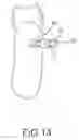 Fig. 13 - ORTHODONTIC APPLIANCE AND METHOD FOR CLASS II AND CLASS III MALOCCLUSION AND DENTAL ASYMMETRIC CORRECTION