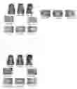 Fig. 17 - ORTHODONTIC APPLIANCE AND METHOD FOR CLASS II AND CLASS III MALOCCLUSION AND DENTAL ASYMMETRIC CORRECTION