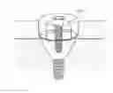 Fig. 01 - DENTAL IMPLANT SYSTEM