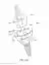 Fig. 41 - DENTAL IMPLANT SYSTEM