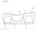Fig. 06 - Method for manufacturing dental prosthesis