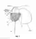 Fig. 08 - Mesh for Hiatal Hernia Repair and Deployment Device