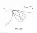Fig. 08 - Adjustable suture button construct