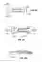 Fig. 09 - Scleral prosthesis for treating presbyopia and other eye disorders and related devices and methods
