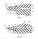 Fig. 04 - Multicomponent intraocular lens