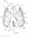 Fig. 01 - Collapsible prosthetic heart valves