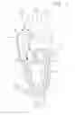 Fig. 02 - Collapsible prosthetic heart valves