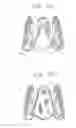 Fig. 06 - Collapsible prosthetic heart valves