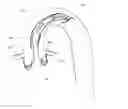 Fig. 01 - SYSTEM AND METHOD FOR PLACING A PERCUTANEOUS VALVE DEVICE