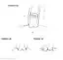 Fig. 02 - SYSTEM AND METHOD FOR PLACING A PERCUTANEOUS VALVE DEVICE