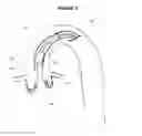 Fig. 03 - SYSTEM AND METHOD FOR PLACING A PERCUTANEOUS VALVE DEVICE