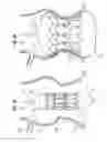 Fig. 04 - Methods for quickly implanting a prosthetic heart valve