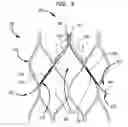Fig. 04 - Leaflet suturing to commissure points for prosthetic heart valve