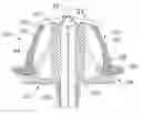 Fig. 01 - Methods of packaging and delivering prosthetic heart valves